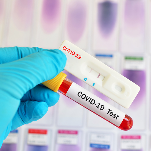 Scientist reviewing COVID test samples