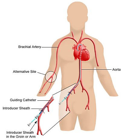 Img_InterventionalProcedures 